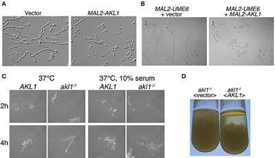 A Global Analysis of Kinase Function in Candida albicans Hyphal Morphogenesis Reveals a Role for the Endocytosis Regulator Akl1